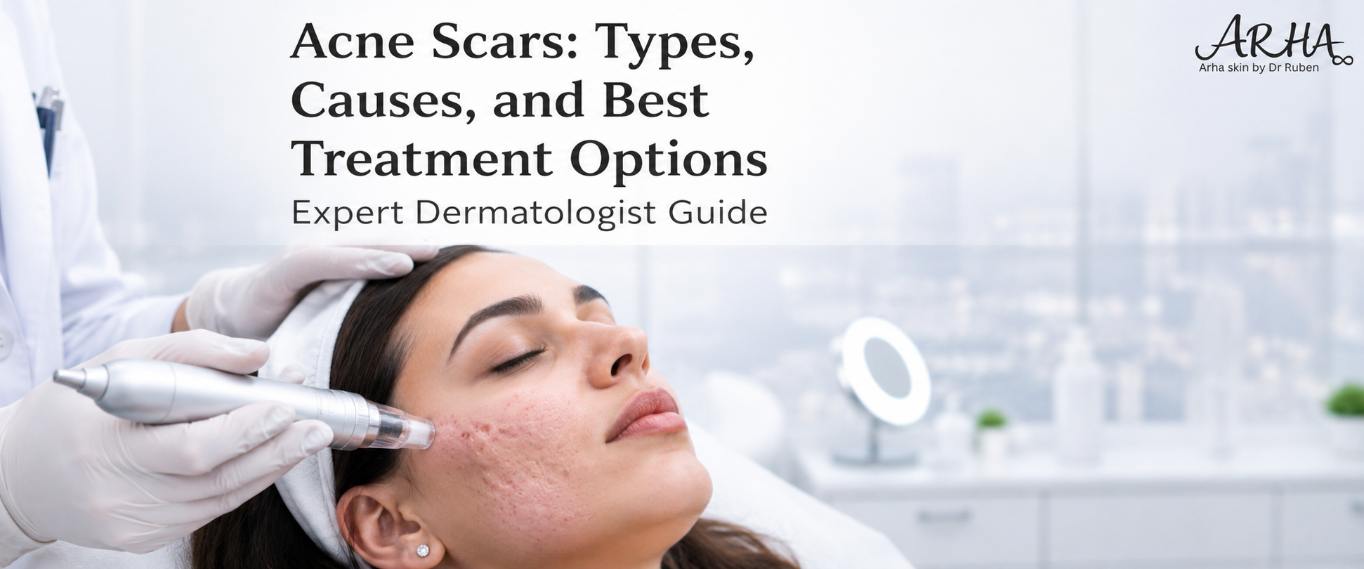 Acne Scars: Types, Causes, and Treatment Options