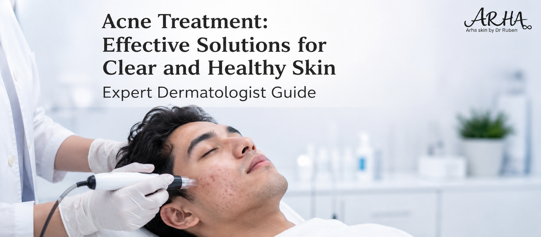 Acne Treatment: Effective Solutions for Clear and Healthy Skin